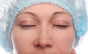 brow lift forehead lift scarring
