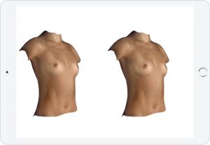 Breast implant sizing options 3d imaging technology best results