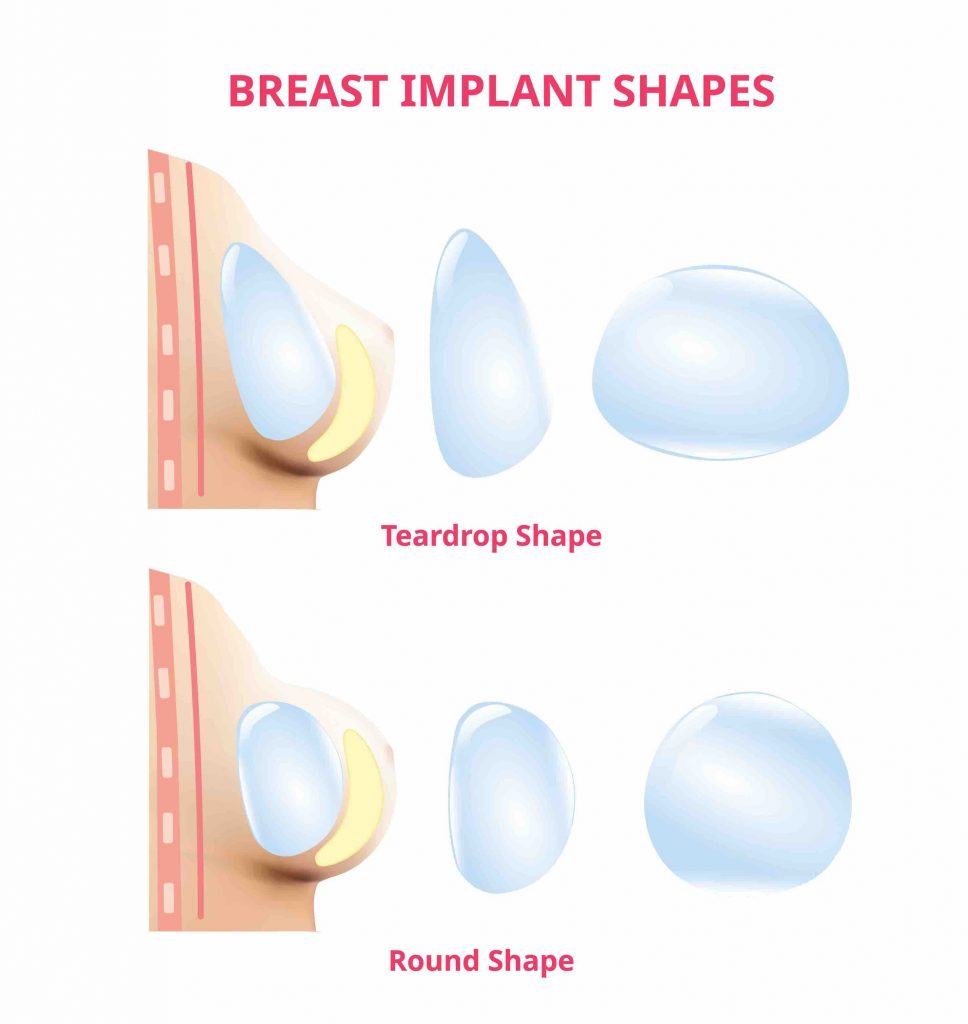 breast implant shape options round vs teardrop