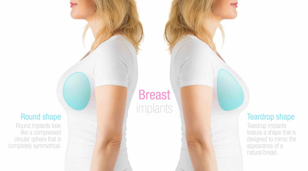 breast implant shapes round vs teardrop