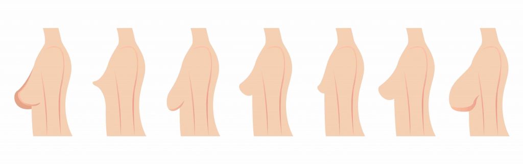 Different Types of Breast Shapes and Sizes