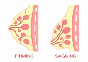 how to measure if your breasts are sagging