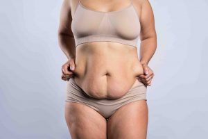 massive weight loss surgery tighten midsection