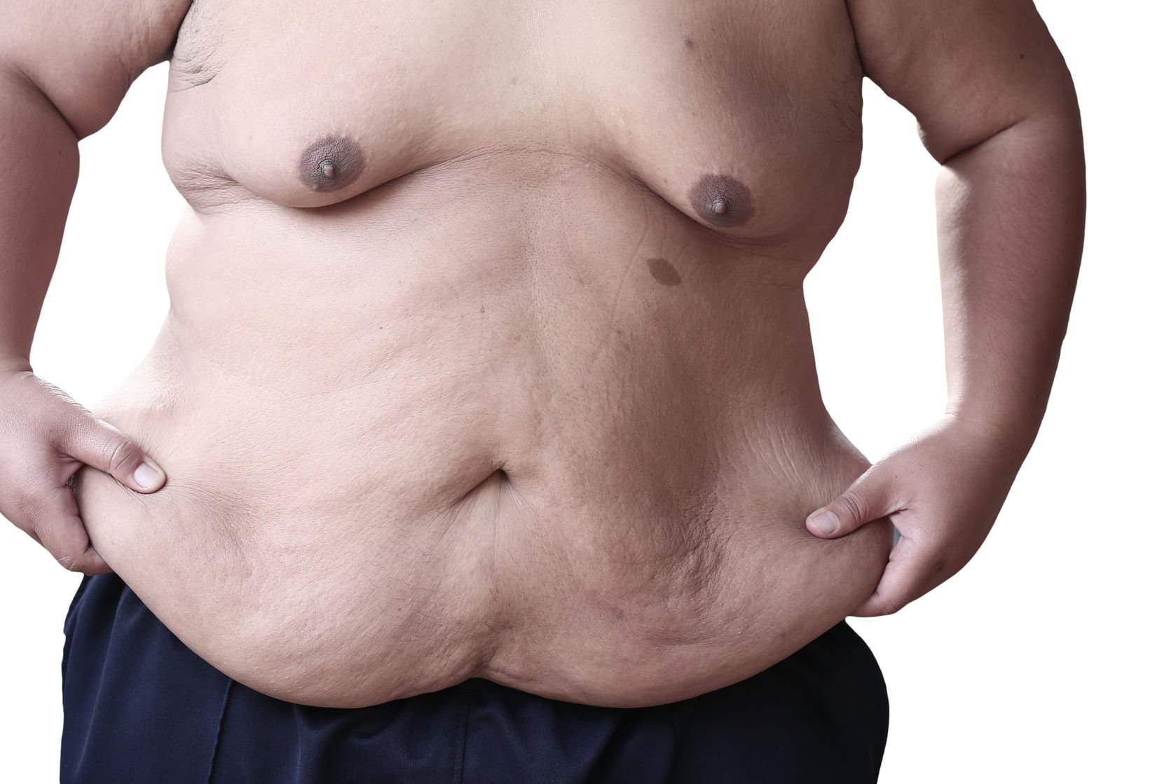 best plastic surgeon to remove excess skin bariatric