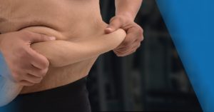 removing excess skin after massive weight loss for men