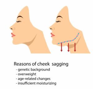 how to reduce sagging cheeks