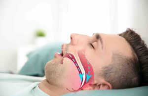 can rhinoplasty treat snoring