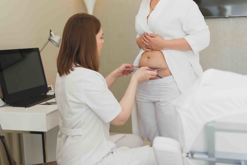 mini-tummy-tuck-surgery