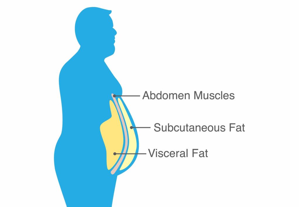 visceral vs subcutaneous fat