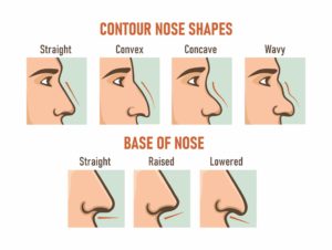 different-types-of-noses