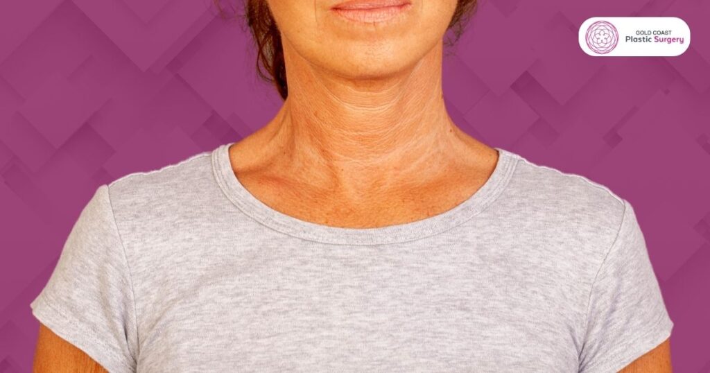 Neck Lines & How to Get Rid of Them Gold Coast Plastic Surgery