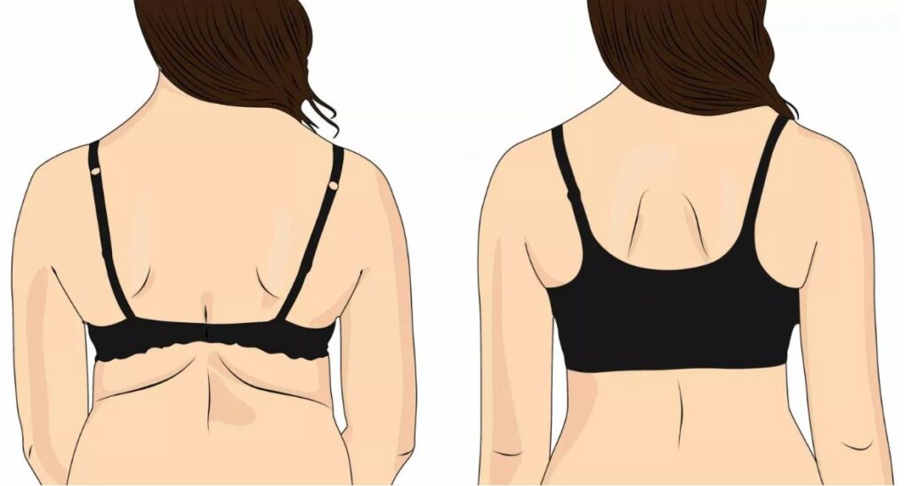 Back Fat & How to Get Rid of It