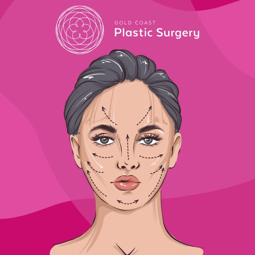 plastic surgery before and after face cosmetic procedure